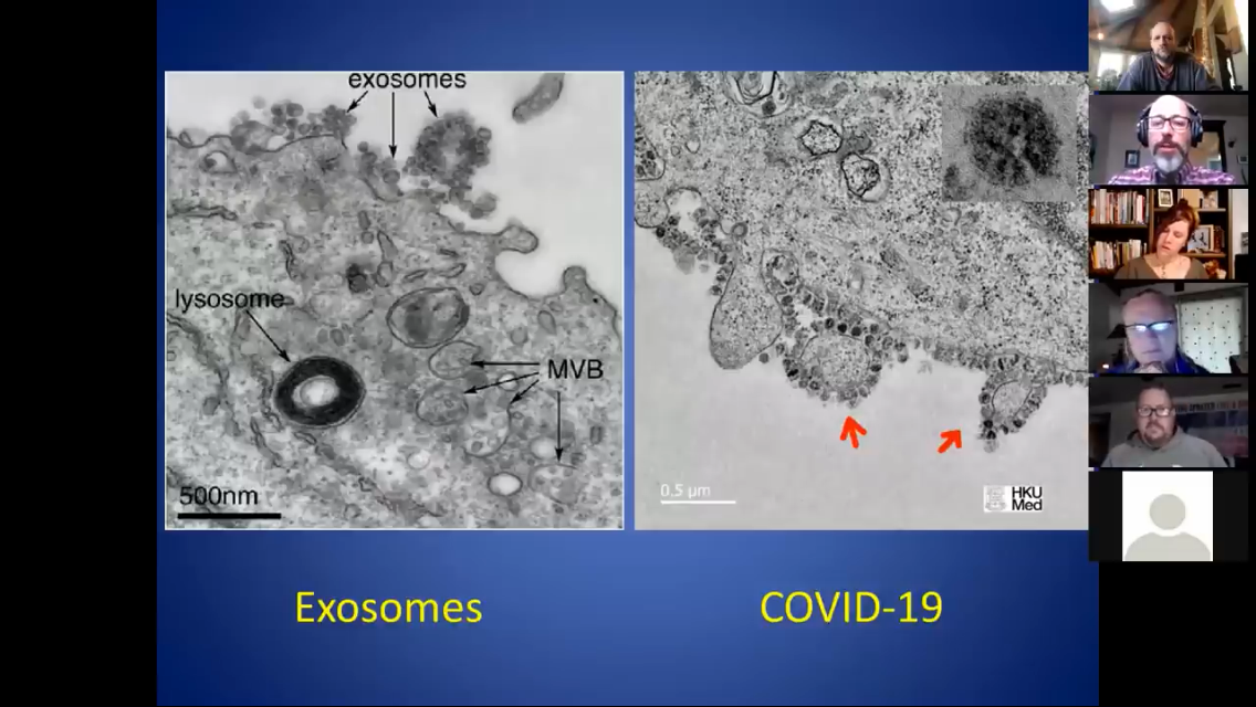An exosome and not a virus – Dr Andrew Kaufman